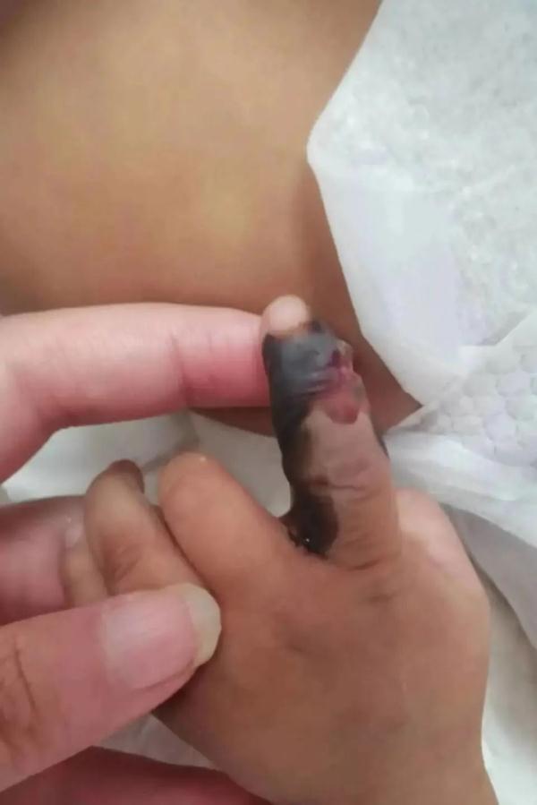 家长顺手一揪,1岁宝宝差点没命……提醒:一定要忍住!