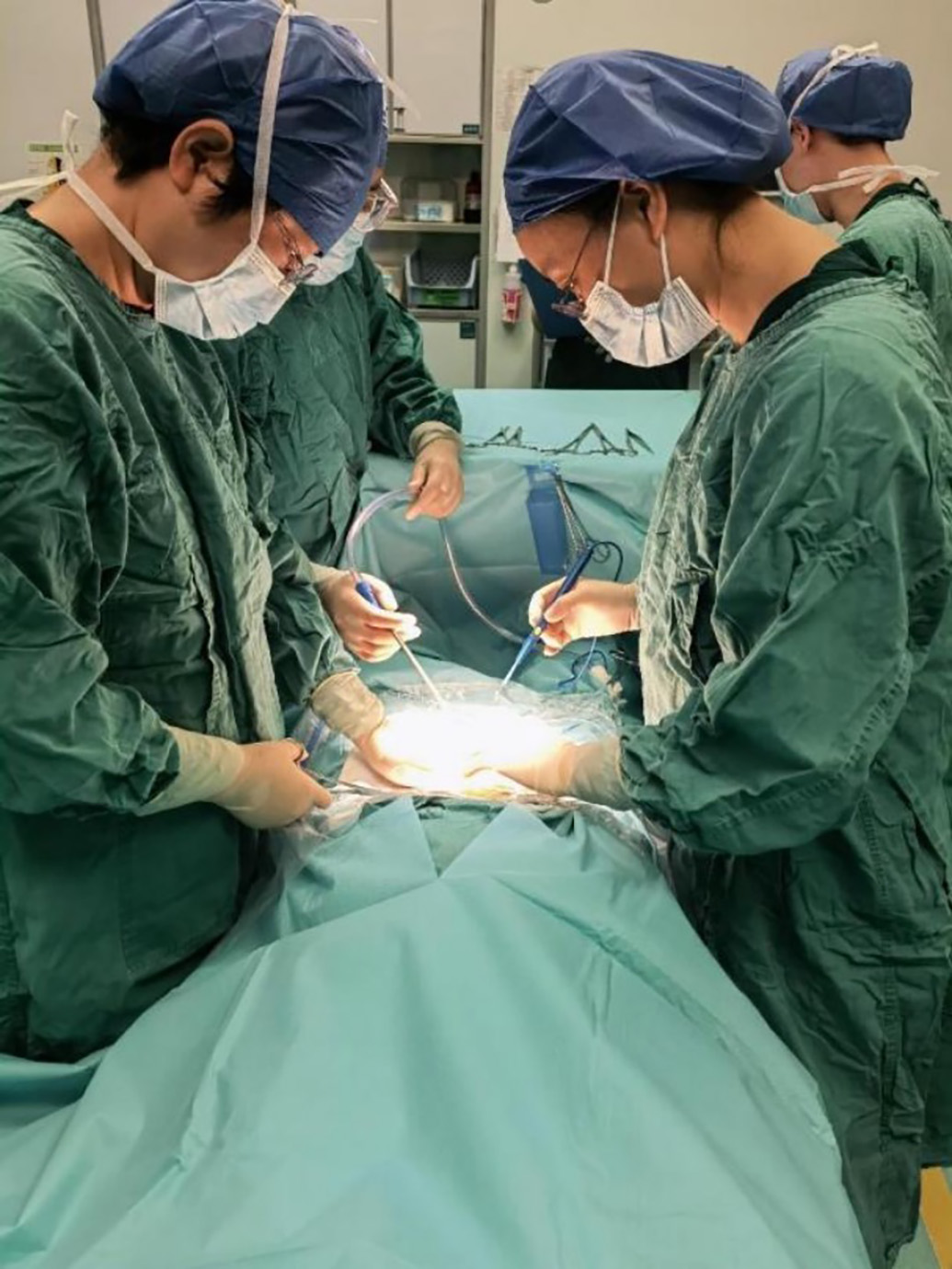 母胎血型不合三次胎死腹中,一孕妇经四次宫内输血后平安产子
