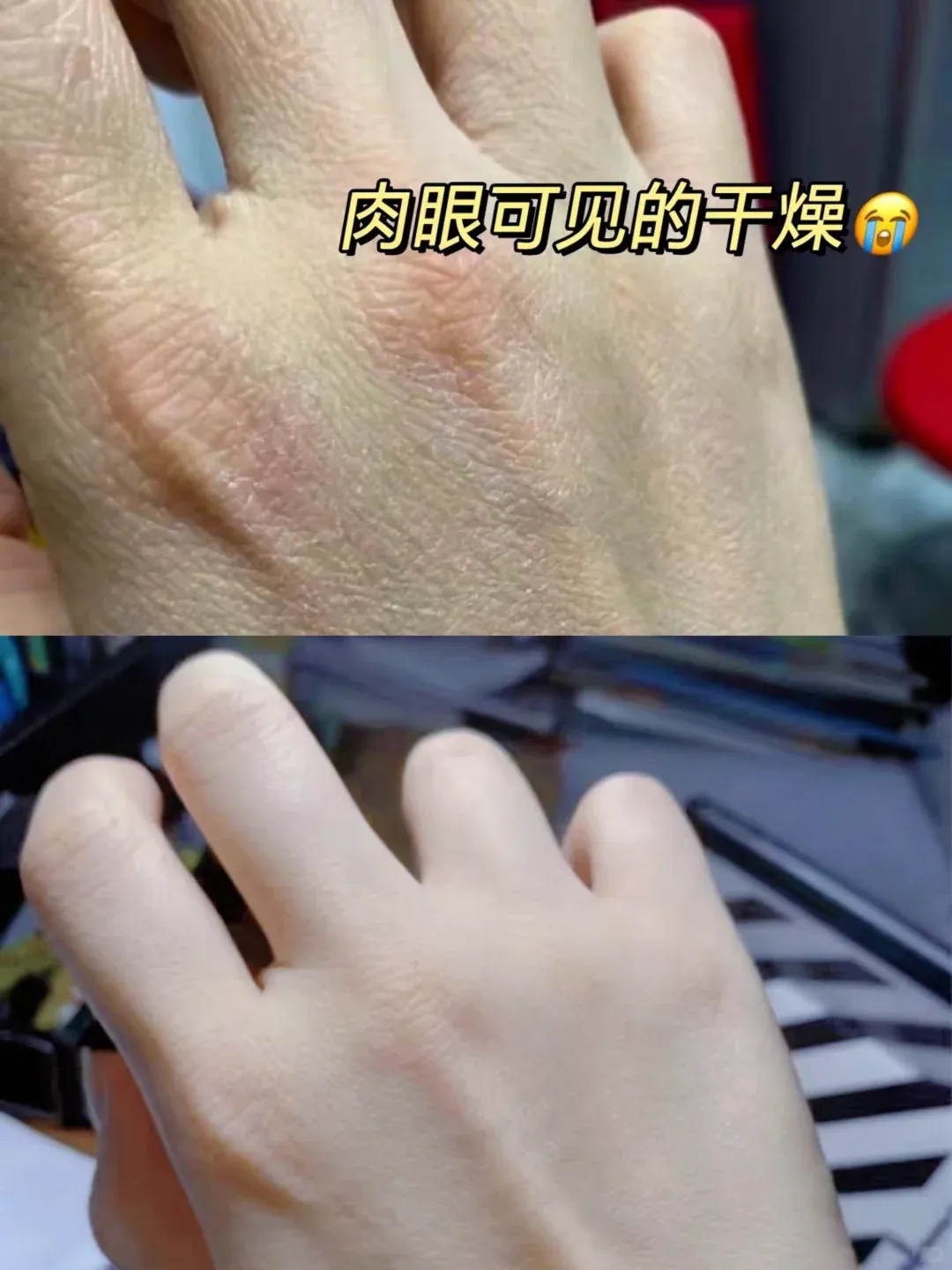 秋冬护手C位！栀诺护手霜，换季干燥 “一键舒缓”～