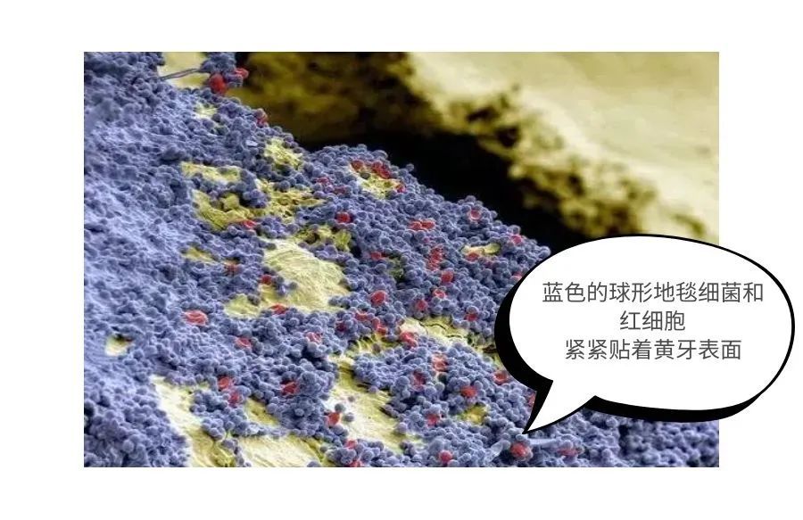 放大1000倍的牙齿太可怕了!看过你肯定会好好刷牙了