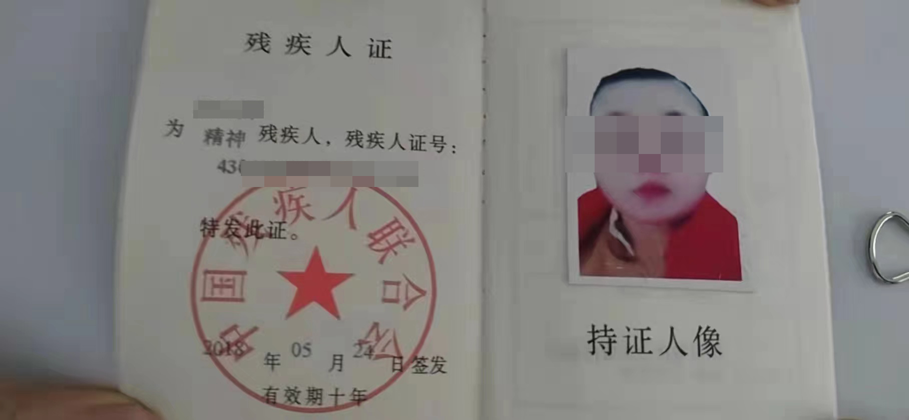 精神残疾,精神残疾鉴定标准