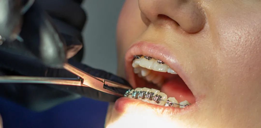 严肃研究：牙医为什么成了女孩们的新幻想对象？