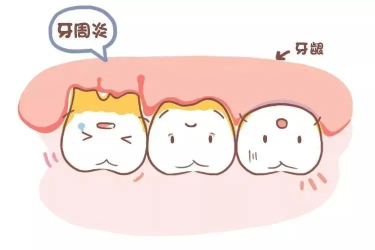 怀孕了，牙疼怎么办？