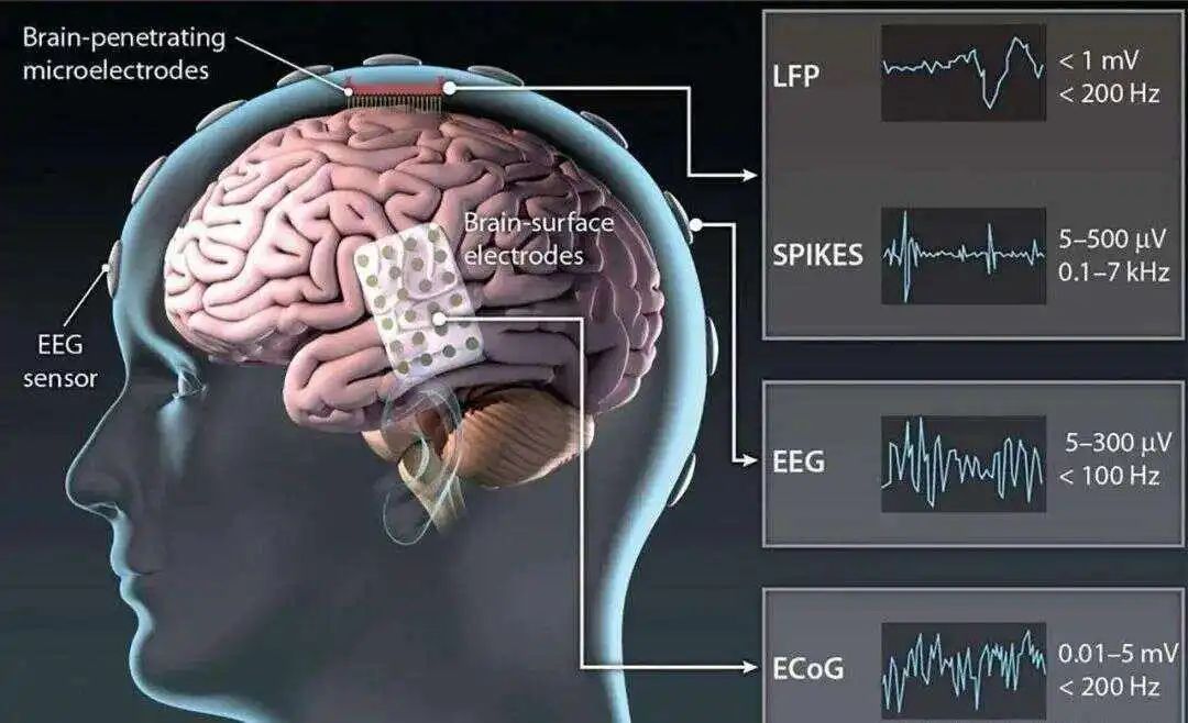 脑控术还是医学革命？脑机接口让人类摆脱AI控制