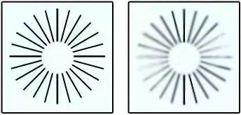 眼睛不同子午线上存在屈光力差异的屈光状态称为散光.