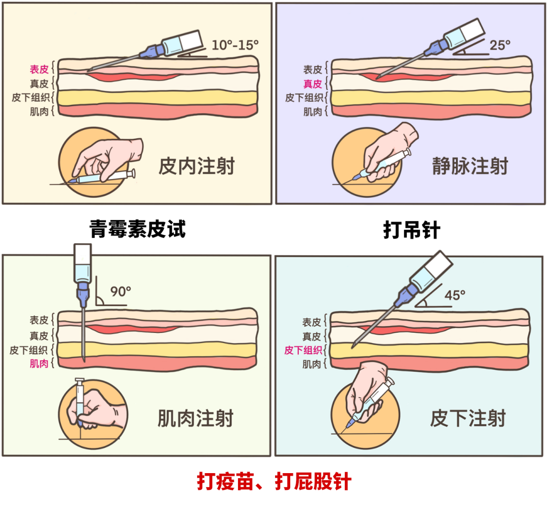 注射,说白了就是将药物打到身体里面,但是因为药物之间的差异非常大