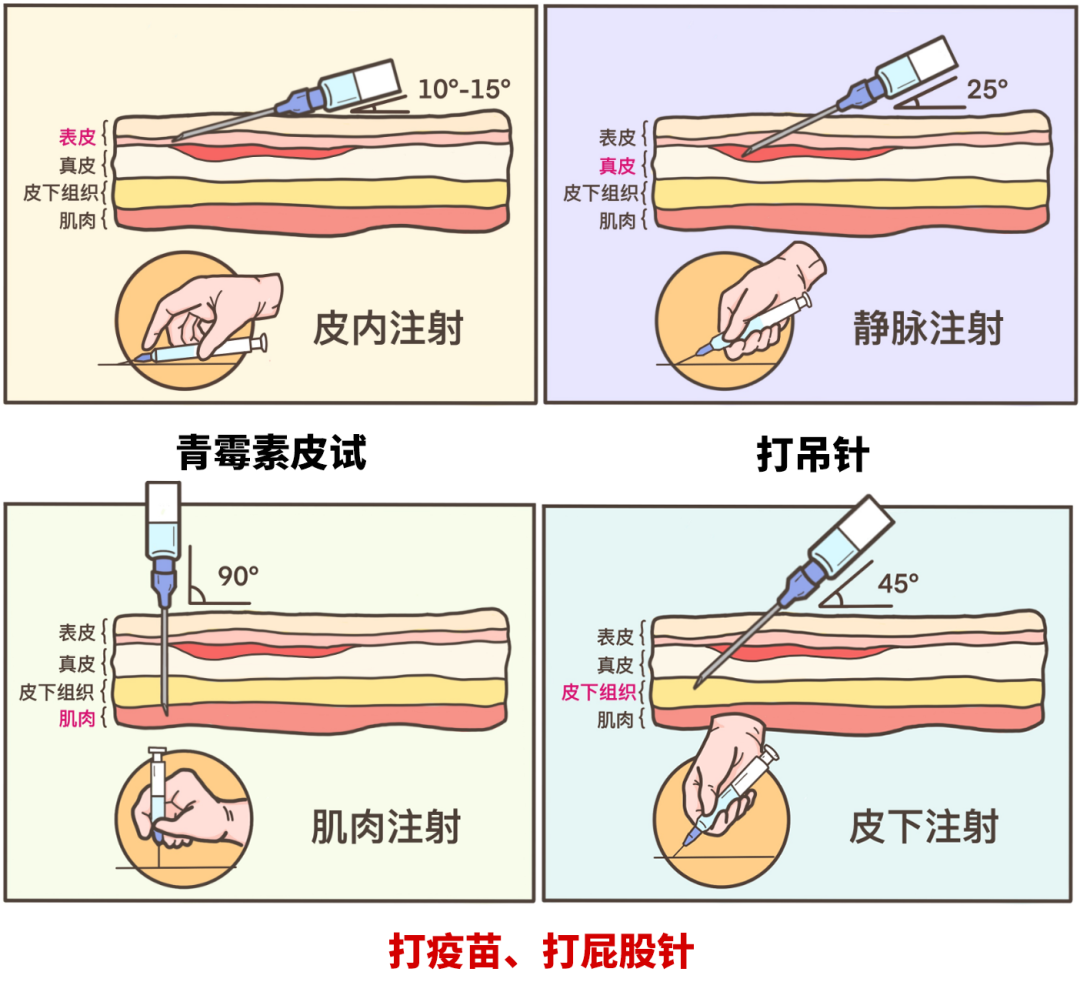 同樣是打針,為什麼有的打胳膊,有的打屁股?