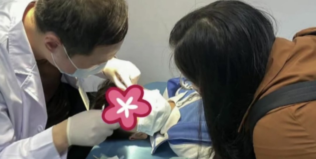 502礁水能粘乒乓球拍嗎（8歲男孩眼睛濺入502膠水，媽媽一番操作粘得更緊了）