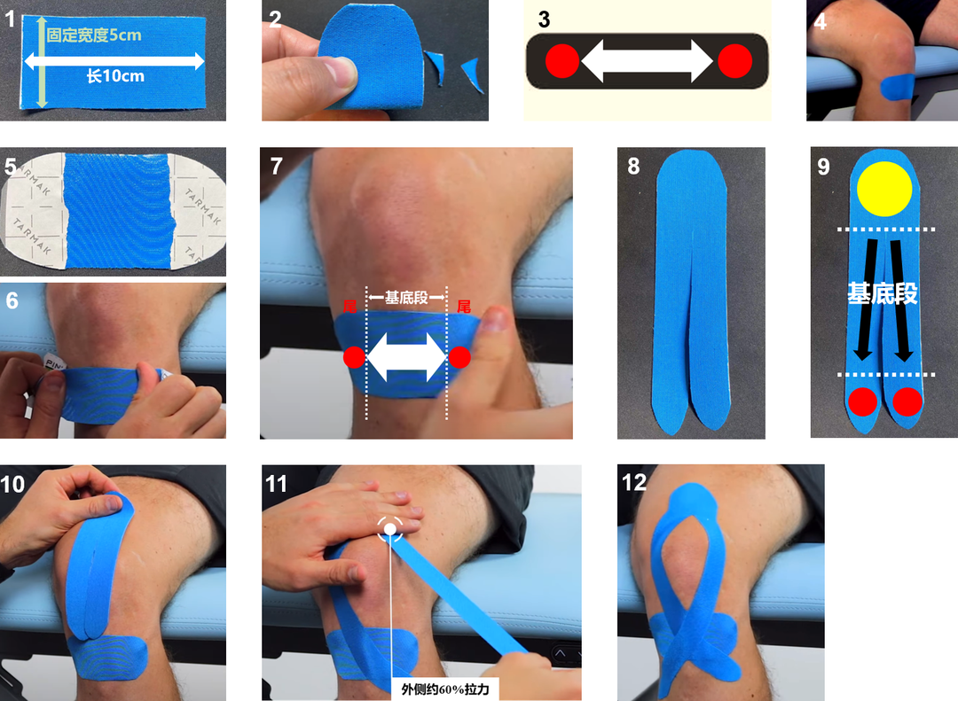 肌内效贴布肩膀贴法图(健身战疫系列——科学利用肌内效贴缓解战"疫"