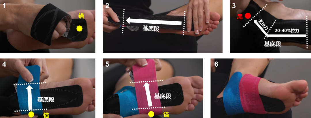 肌内效贴布肩膀贴法图（健身战疫系列-科学利用肌内效贴缓解战“疫”辛劳（二））