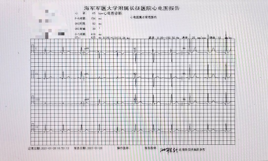 心内科常用检查项目，这么解释一看就懂