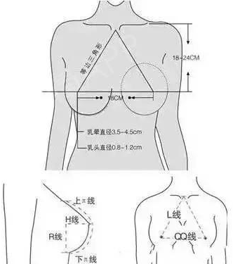 隆胸术前测量图片