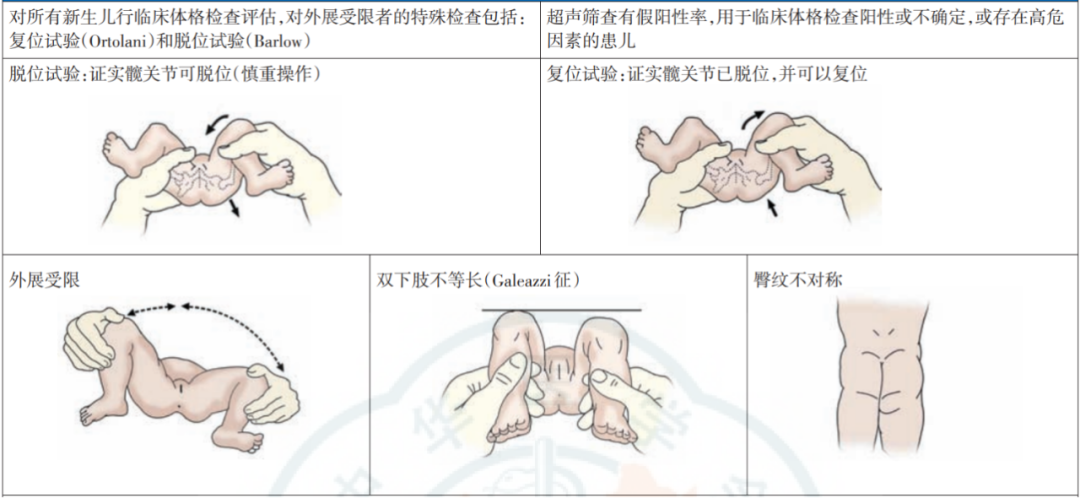 宝宝臀纹不对称需要考虑这个疾病，警惕两个危险因素