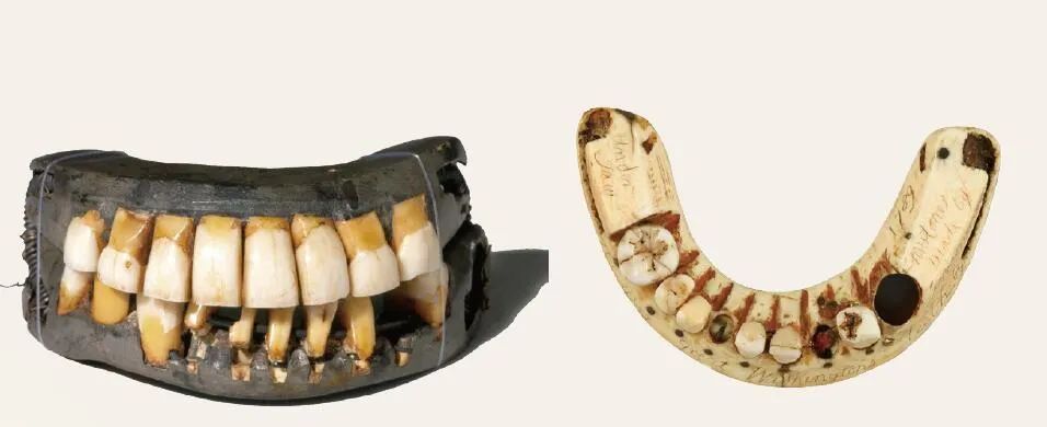 人类为了治疗牙齿曾经历怎样的“酷刑”？