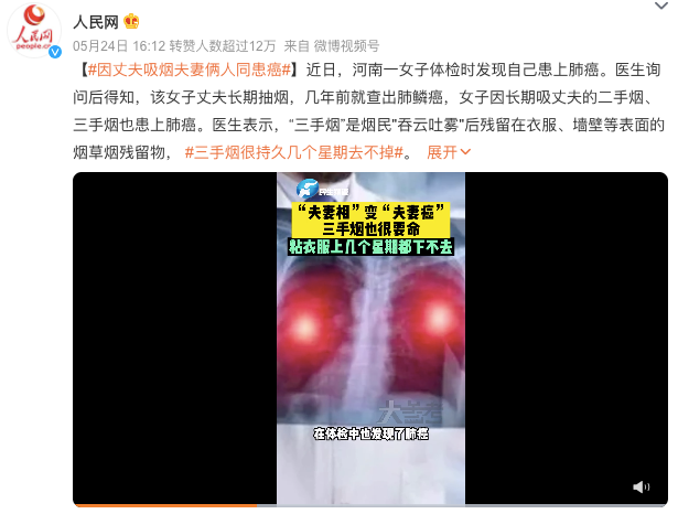 夫妻双双患上肺癌！癌症难道会传染？医生：做好这八件事很重要