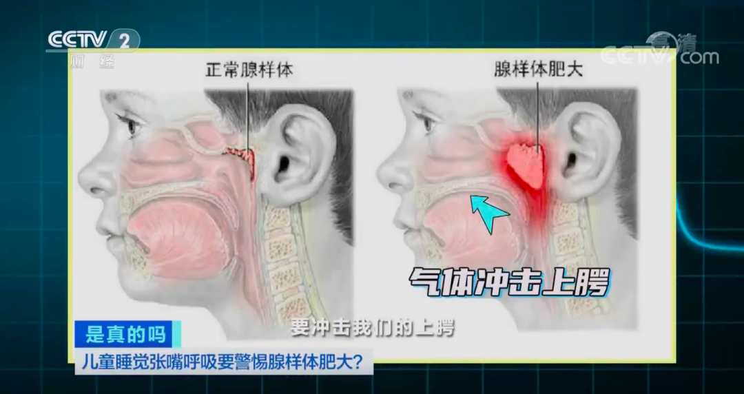 每一次“口呼吸”，都可能在拉低颜值和智商