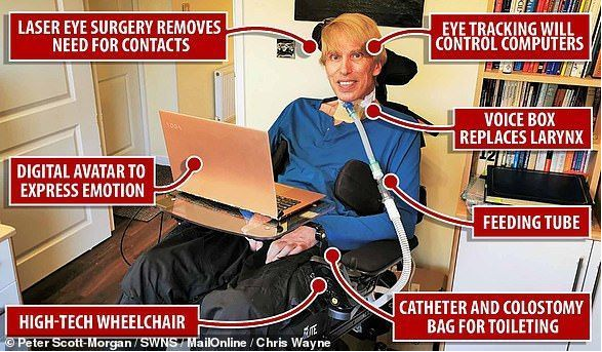 全球首位生化电子人去世 曾为抵抗疾病将自己改造成半肉体半机械