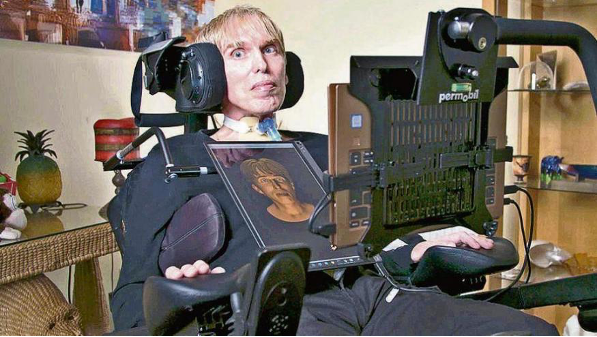 全球首位生化电子人去世 曾为抵抗疾病将自己改造成半肉体半机械