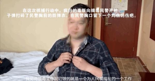 这些伤疤看着都疼，他们却说这是刻在血肉上的荣誉“勋章”