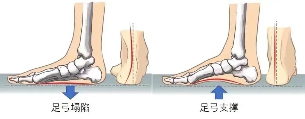 买鞋什么鞋底最好（买鞋什么鞋底最好最舒服）-第5张图片-昕阳网