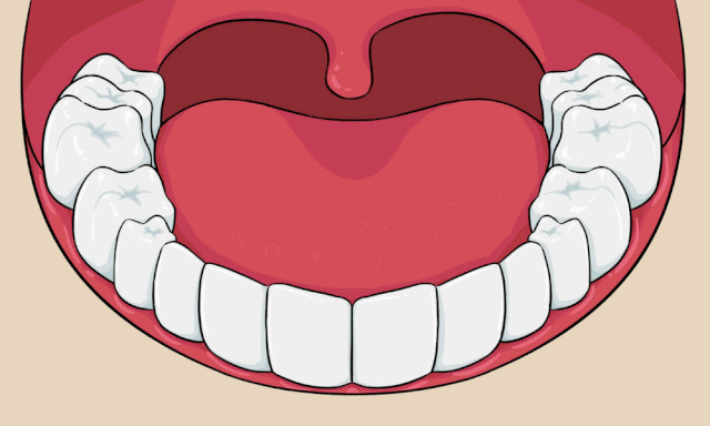 吴铭芳提醒,有时候牙齿的某个点位出现咀嚼痛,但冷热刺激感还不明显