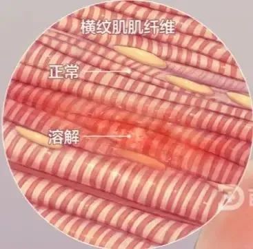 人体肌肉主要分三大类,有骨骼肌,心肌及平滑肌.