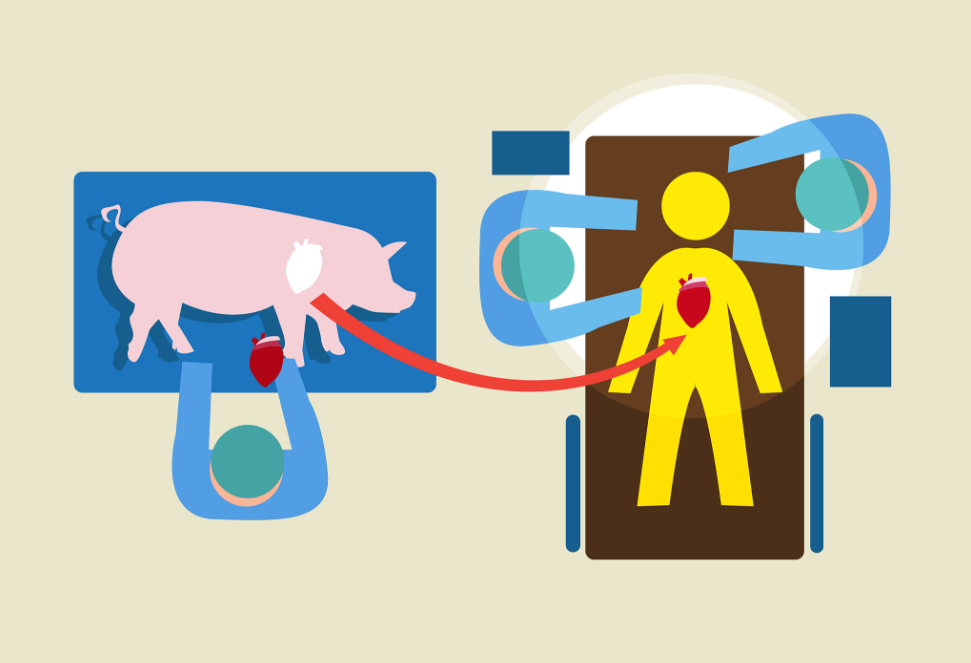 世界首例移植猪心脏患者去世,异种器官移植还有希望吗?