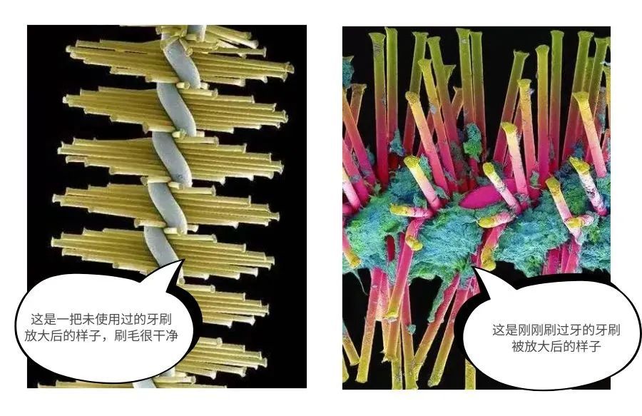 放大1000倍的牙齿太可怕了!看过你肯定会好好刷牙了