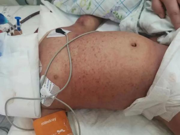 家长顺手一揪,1岁宝宝差点没命……提醒:一定要忍住!