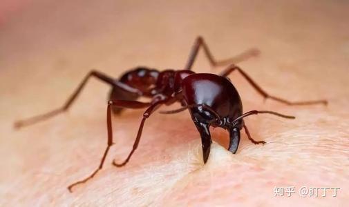 蚁后会咬人吗_白蚁 没有 蚁后 会怎样_会叫的狗不咬人,无声狗咬死人