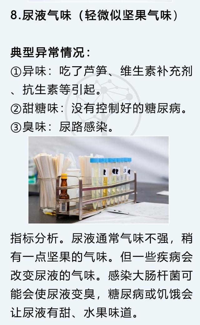 尿常规怎么检查，男性尿常规怎么看（5分钟判断身体健康）
