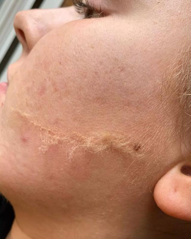 der是什么意思，网络用语der是什么意思（欧美女生迷上了人工磨皮）