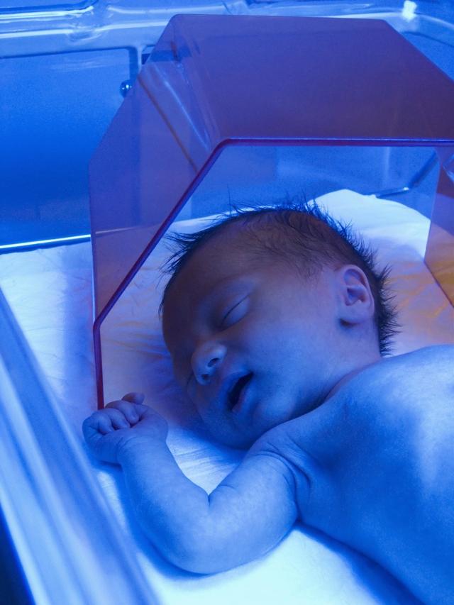 婴儿20天黄疸值15.3怎么回事，宝宝20天黄疸14.5怎么办（新生儿黄疸高是怎么回事）