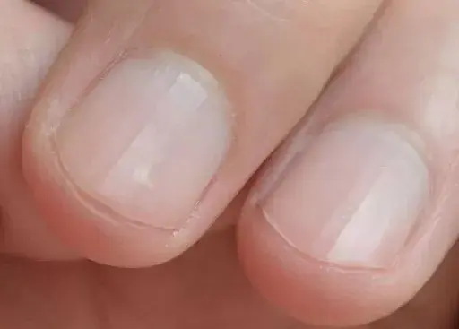 手指上的月牙白代表什么，手指没有月牙是肾虚吗（指甲上的月牙代表什么）