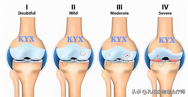膝盖弯曲时疼痛会自愈吗，跑步膝盖疼能自愈吗（膝关节为什么疼痛）