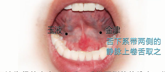 鱼腰的准确位置和作用，个个都是穴位学中的高手