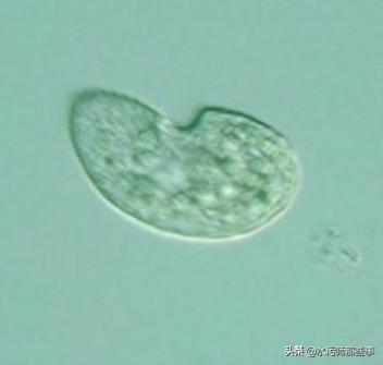 微生物镜检标准是多少，污水处理厂微生物镜检流程与污泥活性分析总结