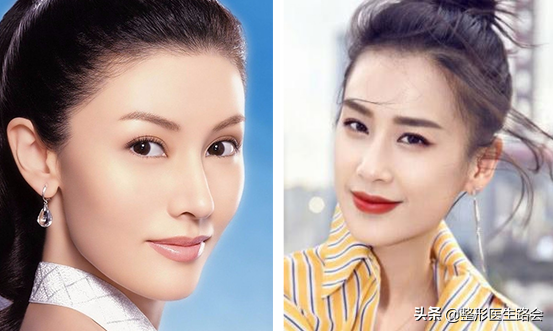 希腊鼻面相,90%的人并不适合"欧式鼻"-相术-荣耀易学