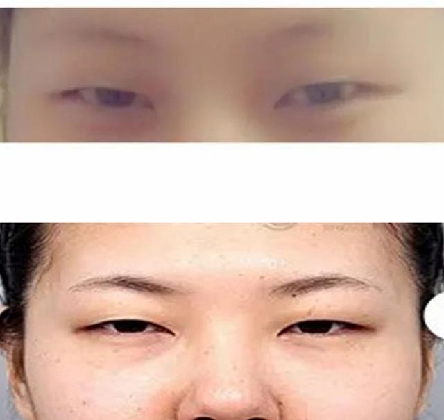单眼皮眼型的种类图解，单眼皮分几种眼型图片（是不是在五大标准眼型中没有像自己这样的）