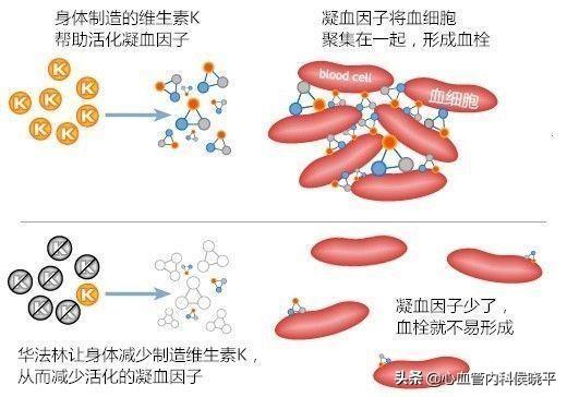 凝血高是什么原因，产后凝血高是什么原因（抗凝治疗的他凝血指标严重超标）