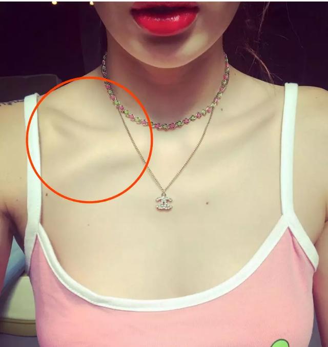 10分钟练出锁骨，10分钟练出锁骨男（泫雅凹锁骨导致变形）