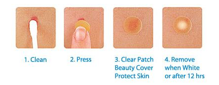 痘痘贴怎么用，脸上长痘痘涂什么药膏（痘痘贴管用吗？怎么用才合适）