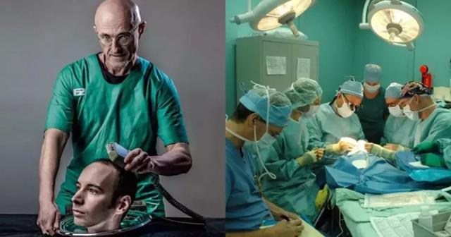  世界上第一位换头手术，捷报：人类首例换头手术成功 