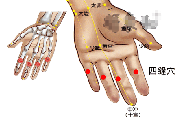 鱼腰的准确位置和作用，个个都是穴位学中的高手