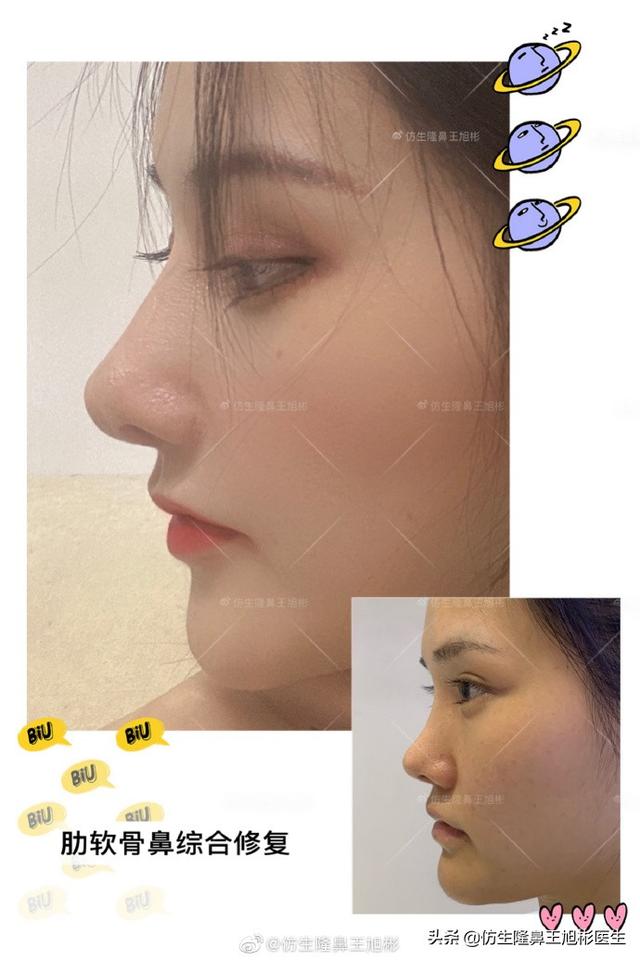 高级脸是什么意思，6种脸型不显老（“月亮脸”逆袭“高级脸”的不二法则是）