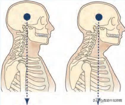 怎么瘦咬肌 最全的瘦咬肌方法，怎么瘦咬肌（谁说你脸方是天生的）