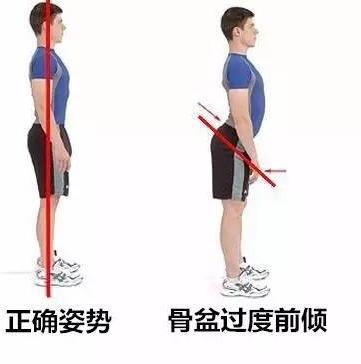 溜肩怎么练成平肩，男生溜肩怎么练成平肩（上斜方肌受着不可承受之重。选对方法）