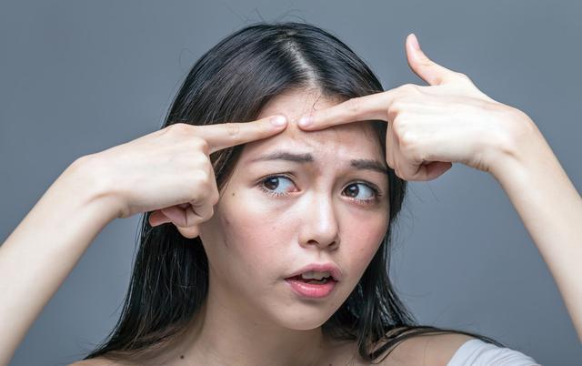 轻度痤疮一天一粒异维a酸，轻度痤疮一天一粒异维a酸会好吗（治疗痤疮时用维A酸类药物）