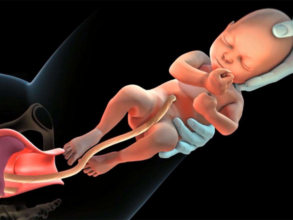 孕30周胎儿臀位图片图片
