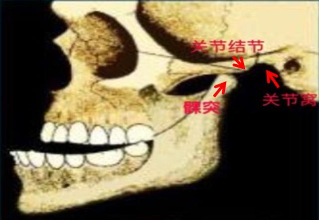 下巴掉了怎么复位，下巴闭口反复长怎么根治（下巴“掉”了怎么办）